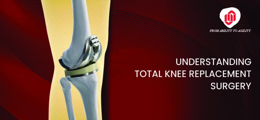 UNDERSTANDING TOTAL KNEE REPLACEMENT SURGERY